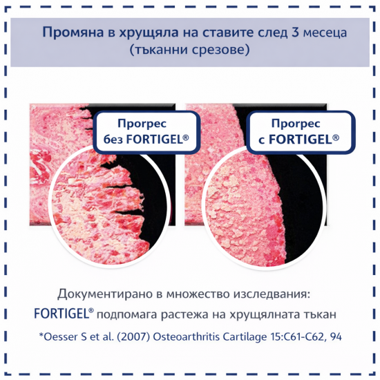Collaging Joint – биоактивен колаген Fortigel® и Protesol® D за стави - 420g 