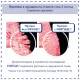 Collaging Joint – биоактивен колаген Fortigel® и Protesol® D за стави - 420g 